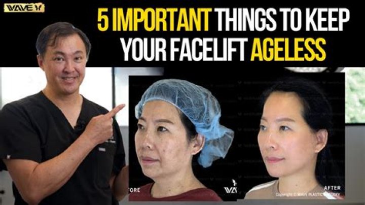 Joyce Vances Facelift Secrets Revealed