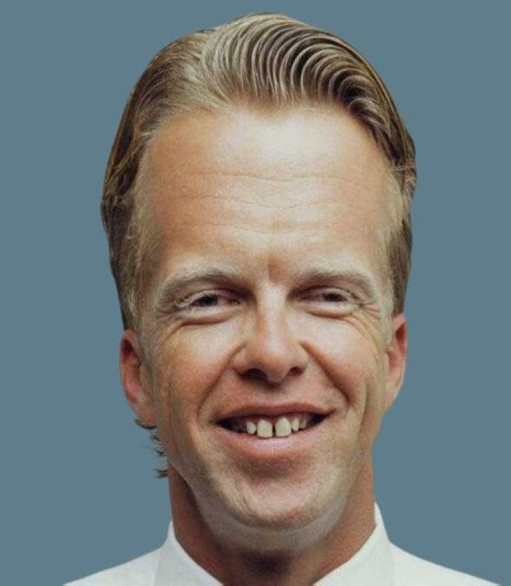 The Biggest Forehead In The World |