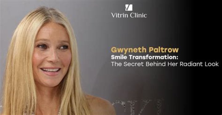 Unlocking The Secrets Behind Her Radiant Smile