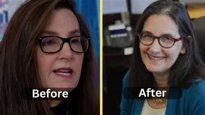 Unveiling The Secrets: Joyce Vance's Facelift Journey