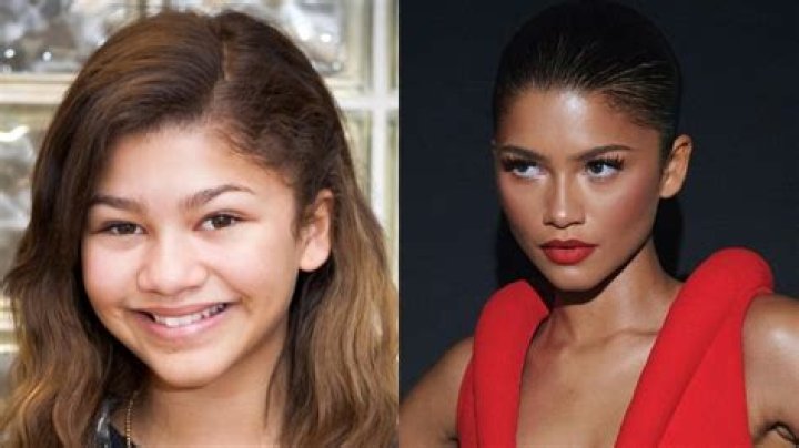 Zendaya Nose Job: Uncovering Truth And Insights